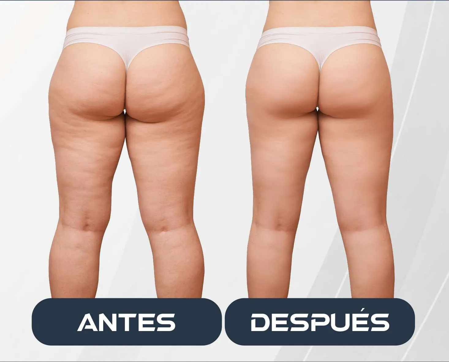 presoterapia 6 canales